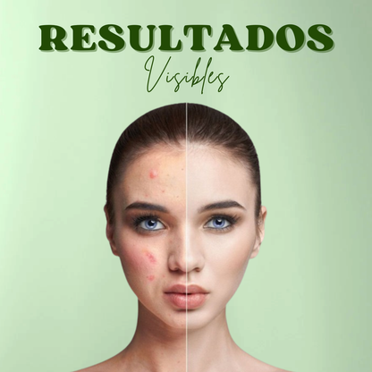 GREEN MASK™ | HOY 2X1 Mascarilla Efecto 10 Minutos + Rutina Skincare GRATIS