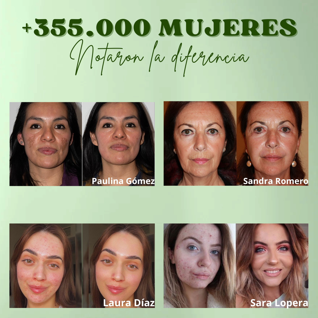 GREEN MASK™ | HOY 2X1 Mascarilla Efecto 10 Minutos + Rutina Skincare GRATIS